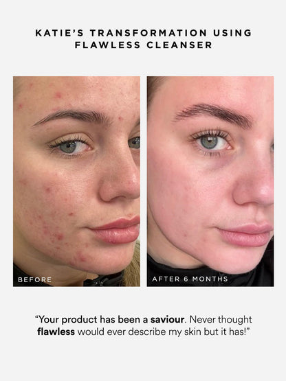 Dr Sam's Flawless Cleanser Nettoyant Gelée Démaquillant 200ml