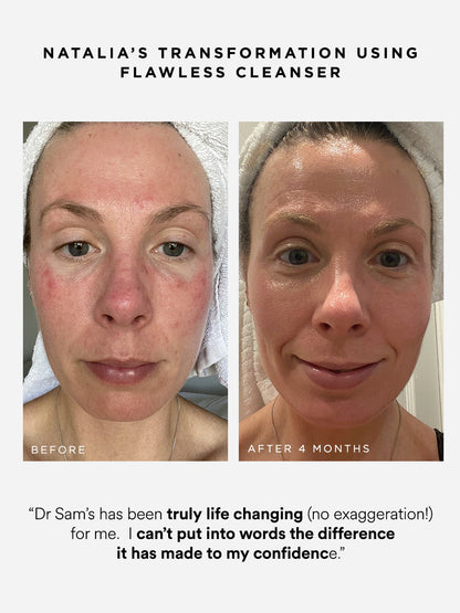 Dr Sam's Flawless Cleanser Nettoyant Gelée Démaquillant 200ml