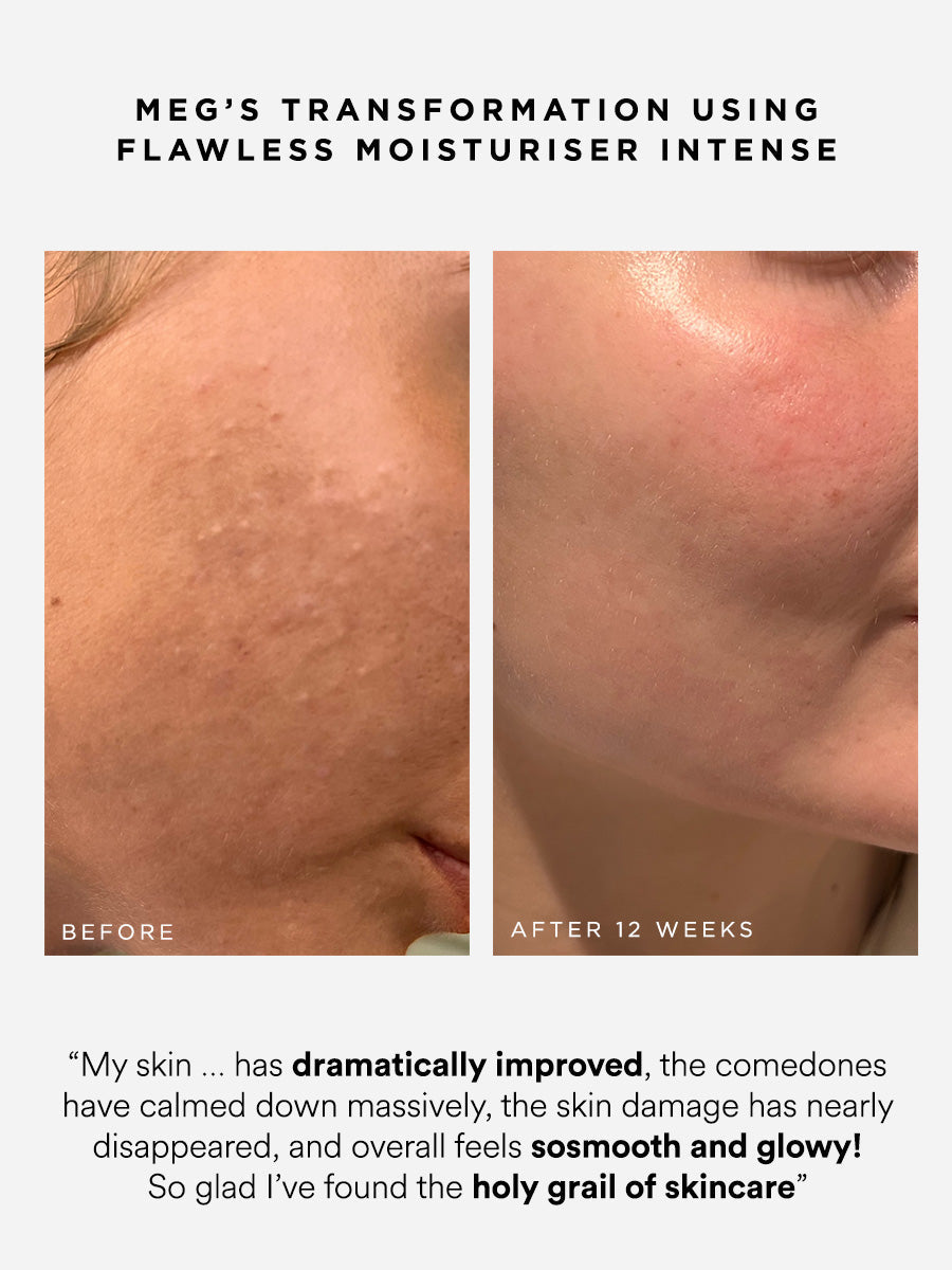 Dr Sam's Flawless Moisturiser Intense Crème Barrière NAD+ 50ml