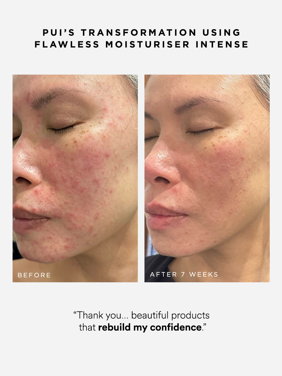 Dr Sam's Flawless Moisturiser Intense Crème Barrière NAD+ 50ml