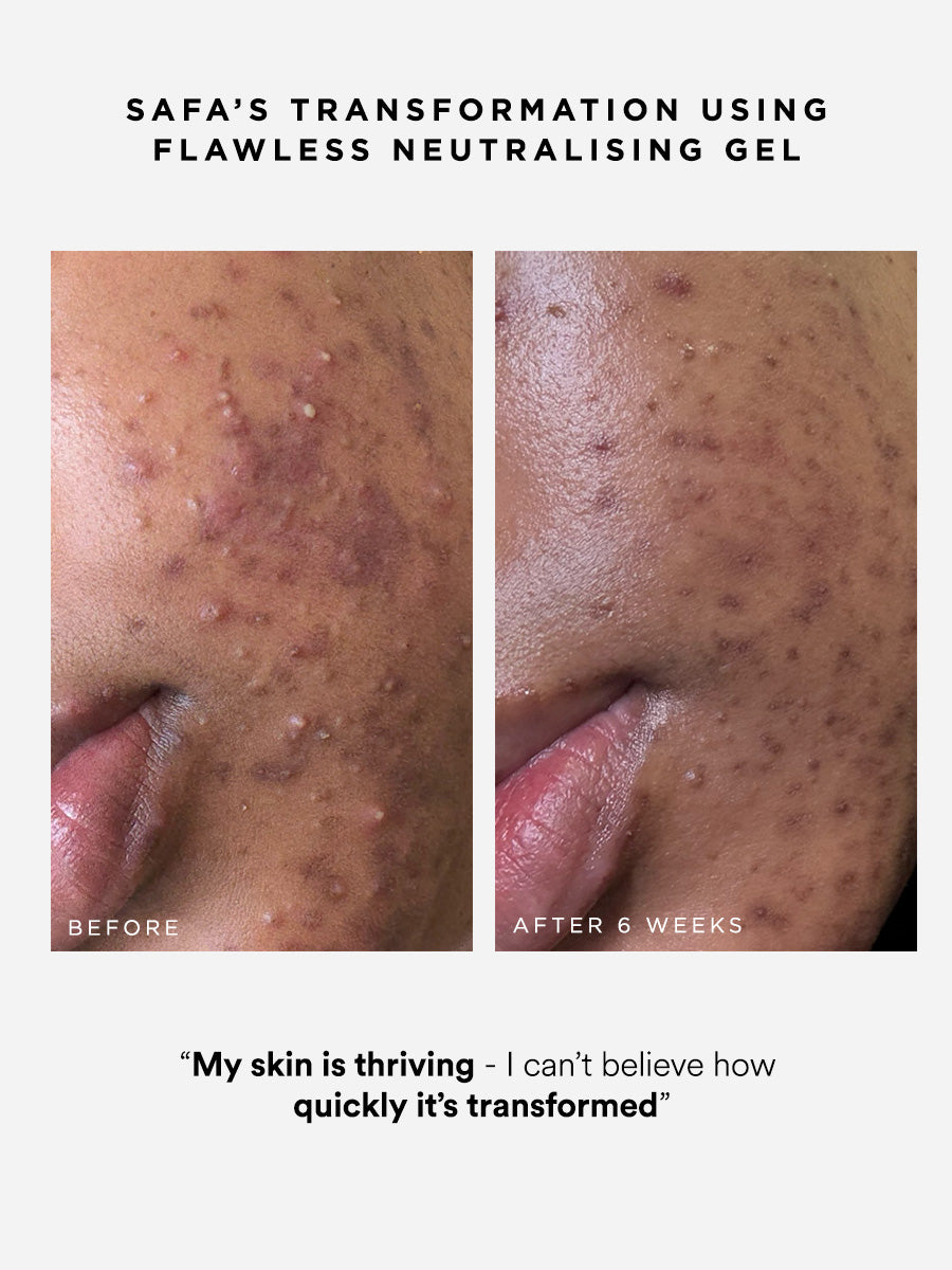 Dr Sam's Flawless Neutralising Gel Sérum Anti-Imperfections 30ml
