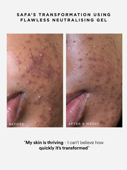 Dr Sam's Flawless Neutralising Gel Sérum Anti-Imperfections 30ml