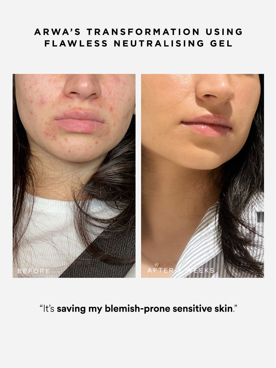 Dr Sam's Flawless Neutralising Gel Sérum Anti-Imperfections 30ml