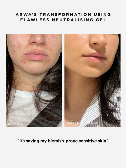 Dr Sam's Flawless Neutralising Gel Sérum Anti-Imperfections 30ml