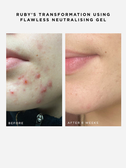 Dr Sam's Flawless Neutralising Gel Sérum Anti-Imperfections 30ml