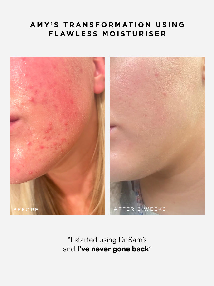 Dr Sam's Flawless Moisturiser Crème Hydratante Gelée 100ml