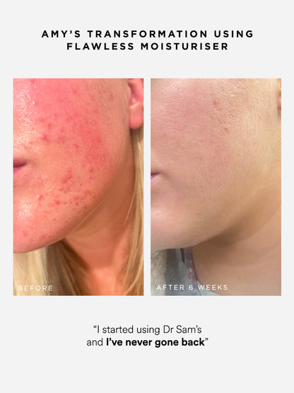 Dr Sam's Flawless Moisturiser Crème Hydratante Gelée 100ml